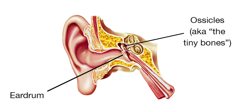 Illustration for article titled My Cyborg Ear: How a Surgeon and Titanium Cured My Lifelong Deafness
